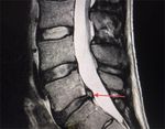 Horse Kick to the Abdomen Causing a Triad of Injury: A Case Report - Cureus