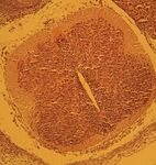 EVALUATION OF ANTIOXIDANT EFFECTS OF Nigella sativa - EXTRACT ON THE ULTRA STRUCTURE OF NEURAL TUBE DEFECTS IN DIABETIC RATS'S OFFSPRING