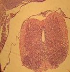 EVALUATION OF ANTIOXIDANT EFFECTS OF Nigella sativa - EXTRACT ON THE ULTRA STRUCTURE OF NEURAL TUBE DEFECTS IN DIABETIC RATS'S OFFSPRING