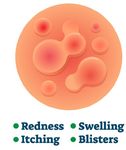 Poison Ivy, Oak, & Sumac Fact Sheet