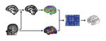 White matter network alterations in patients with depersonalization/derealization disorder