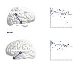 White matter network alterations in patients with depersonalization/derealization disorder