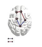 White matter network alterations in patients with depersonalization/derealization disorder