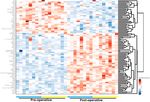 Serum Proteomics of Older Patients Undergoing Major Cardiac Surgery: Identification of Biomarkers Associated With Postoperative Delirium