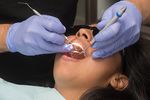 Root Canal: Treatment And After Care