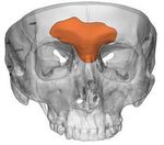 Point of care virtual surgical planning and 3D printing in facial gender confirmation surgery: a narrative review