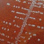 Human, cattle and goat blood as substitutes for sheep blood in blood-supplemented culture media