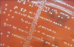 Human, cattle and goat blood as substitutes for sheep blood in blood-supplemented culture media
