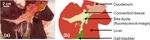Indocyanine-green-loaded microballoons for biliary imaging in cholecystectomy