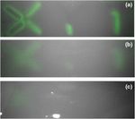 Indocyanine-green-loaded microballoons for biliary imaging in cholecystectomy