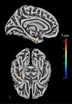 Late chronotype is linked to greater cortical thickness in the left fusiform and entorhinal gyri