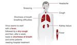 Update COVID-19 (Coronavirus) - 2 March 2020 Dr Tony Holohan Chief Medical Officer Department of Health - Failte Ireland