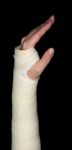 Fractured wrist - after surgery - Information for patients Introduction - Imperial College Healthcare ...