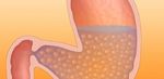 Updates in the Medical Management of Obesity