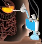 Updates in the Medical Management of Obesity