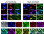 A Fast and Efficient Approach to Obtaining High-Purity Glioma Stem Cell Culture