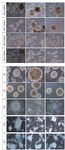 A Fast and Efficient Approach to Obtaining High-Purity Glioma Stem Cell Culture