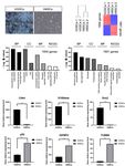 A Fast and Efficient Approach to Obtaining High-Purity Glioma Stem Cell Culture