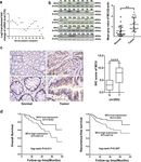 MCU-induced mitochondrial calcium uptake promotes mitochondrial biogenesis and colorectal cancer growth - Nature