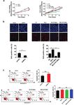 MCU-induced mitochondrial calcium uptake promotes mitochondrial biogenesis and colorectal cancer growth - Nature