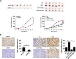 MCU-induced mitochondrial calcium uptake promotes mitochondrial biogenesis and colorectal cancer growth - Nature