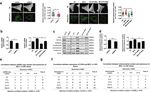 MCU-induced mitochondrial calcium uptake promotes mitochondrial biogenesis and colorectal cancer growth - Nature