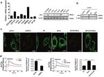 MCU-induced mitochondrial calcium uptake promotes mitochondrial biogenesis and colorectal cancer growth - Nature