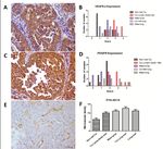 Deregulation of VEGFR-2 and PGFR expression and microvascular density in a triple-negative model of canine malignant mammary tumors with lymph ...