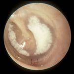 Hearing Loss Case - Click to Begin - A Self-Directed Learning Module Department of Otolaryngology - Head & Neck Surgery - Western University