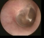 Hearing Loss Case - Click to Begin - A Self-Directed Learning Module Department of Otolaryngology - Head & Neck Surgery - Western University