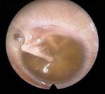 Hearing Loss Case - Click to Begin - A Self-Directed Learning Module Department of Otolaryngology - Head & Neck Surgery - Western University
