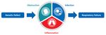 Santhera Pharmaceuticals - Developing medicines to meet the needs of patients living with rare diseases