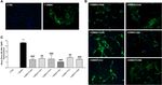 Quercetin can reduce viral RNA level of O'nyong nyong virus and resulting innate immune cytokine responses in cultured human synovial fibroblasts ...