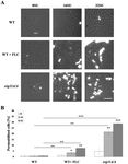 Fluconazole and Lipopeptide Surfactin Interplay During Candida albicans Plasma Membrane and Cell Wall Remodeling Increases Fungal Immune System ...
