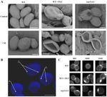 Fluconazole and Lipopeptide Surfactin Interplay During Candida albicans Plasma Membrane and Cell Wall Remodeling Increases Fungal Immune System ...