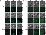 Fluconazole and Lipopeptide Surfactin Interplay During Candida albicans Plasma Membrane and Cell Wall Remodeling Increases Fungal Immune System ...