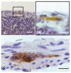 Faecal shedding, alimentary clearance and intestinal spread of prions in hamsters fed with scrapie