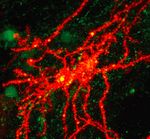 Old Habit-Controlling Neurons May Also Help the Brain Learn
