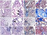 Ketogenic diet restrains aging-induced exacerbation of coronavirus infection in mice - eLife
