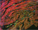 Ketogenic diet restrains aging-induced exacerbation of coronavirus infection in mice - eLife