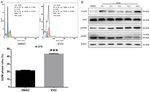 Evodiamine induces reactive oxygen species dependent apoptosis and necroptosis in human melanoma A 375 cells - Spandidos Publications