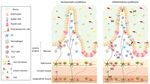 The Gut-Brain Axis in Multiple Sclerosis. Is Its Dysfunction a Pathological Trigger or a Consequence of the Disease?