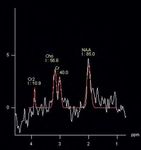 Towards Understanding the Whiplash Condition at 3 Tesla