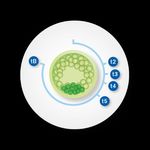 VITROLIFE AB (PUBL) Vitrolife acquires Igenomix Creates a global leader in reproductive health July, 9 2021
