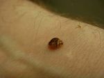 A HOME OWNER'S GUIDE TO HUMAN BED BUGS - Cimex lectularius L., C. hemipterus Fabr. (Cimicidae: Heteroptera)