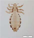 Scabies and Pediculosis in Penitentiary Institutions in Poland-A Study of Ectoparasitoses in Confinement Conditions - MDPI