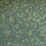 3D INSIGHT LIVER MICROTISSUES - HUMAN LIVER RAT LIVER HEPG2 LIVER TOXICOLOGY SERVICES