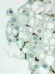 3D INSIGHT LIVER MICROTISSUES - HUMAN LIVER RAT LIVER HEPG2 LIVER TOXICOLOGY SERVICES