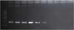 A LAMP-SNP Assay Detecting C580Y Mutation in