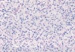 An Introduction to Brain Tumours and Neuroanatomy - Dr. Ruman Rahman Assistant Professor of Molecular Neuro-Oncology - Introduction to brain ...